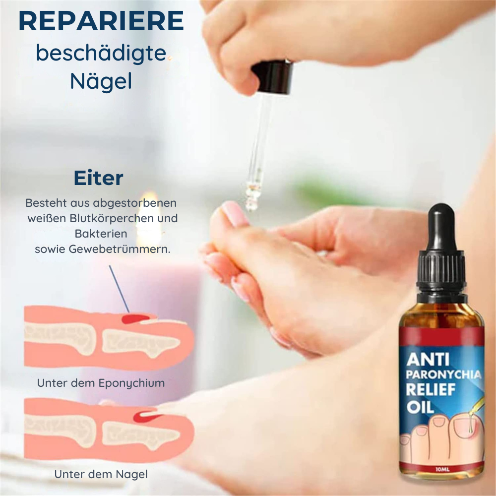 NägelBeruhigen™ Anti-Paronychia-Hilfsöl