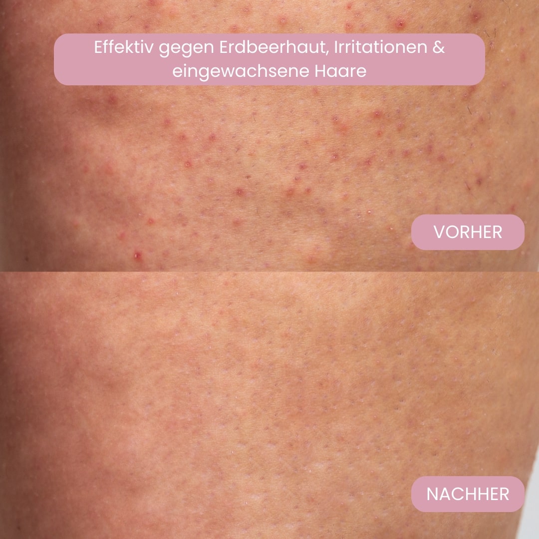 Intimrasierer für Frauen | Elektrischer Damenrasierer für intime Bereiche | Bikini-Trimmer | Femora